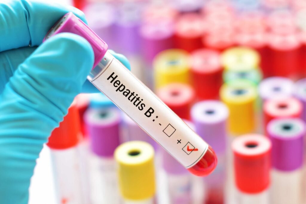 hepatit b əlamətləri və müalicəsi